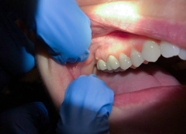 Best Emergency Dentist for Kids  in Ponder, TX