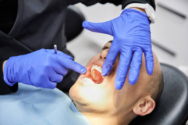 Best Teeth Whitening  in Ponder, TX